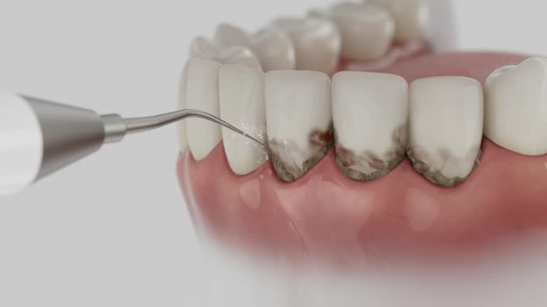 Trusted Tooth Extraction service in Mount Vernon, MD - Dentist Open Now